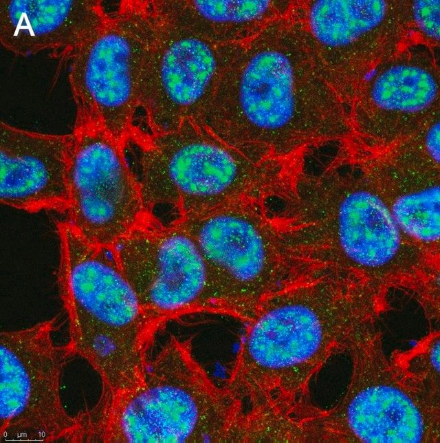 Anti-TET2 Antibody, clone 4L14 ZooMAb<sup>®</sup> Rabbit Monoclonal