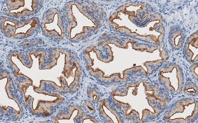 Anti-TMPRSS2 Antibody, clone 1B20 ZooMAb<sup>®</sup> Rabbit Monoclonal