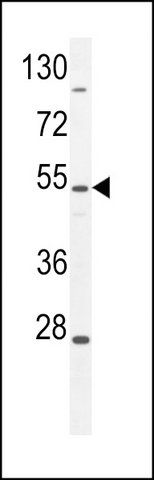 ANTI-ZIK1 (CENTER) antibody produced in rabbit