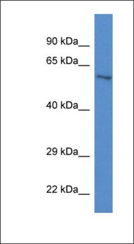 Anti-ZKSCAN1 antibody produced in rabbit