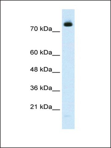 Anti-ZMyM3 (AB1) antibody produced in rabbit