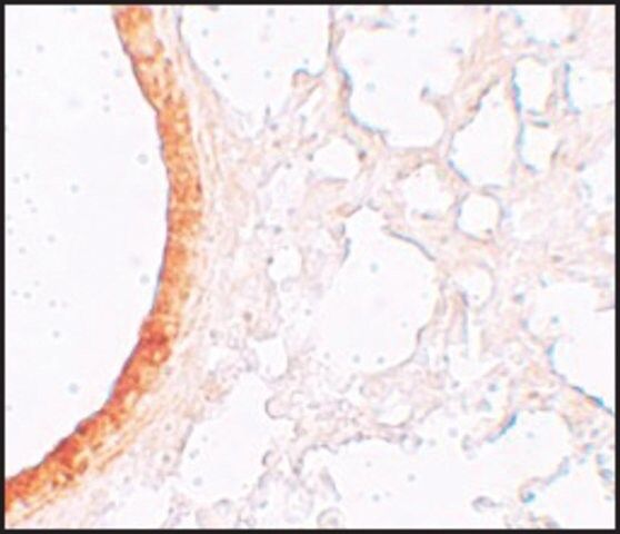 Anti-ZIP3 antibody produced in rabbit