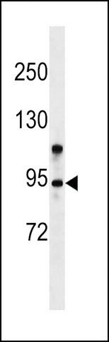 ANTI-ZMYM6(N-TERMINAL) antibody produced in rabbit