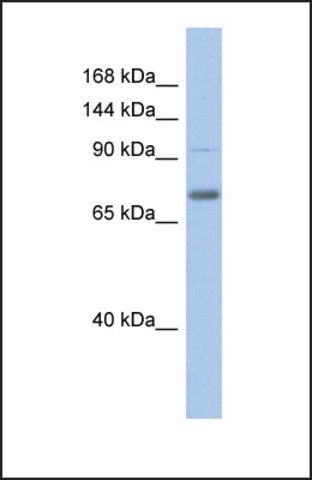 Anti-ZKSCAN5, (N-terminal) antibody produced in rabbit