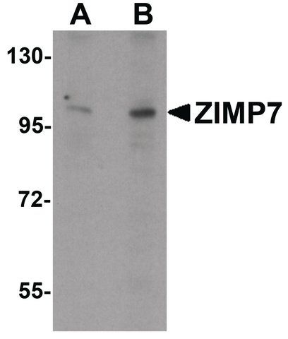 Anti-ZIMP7 antibody produced in rabbit