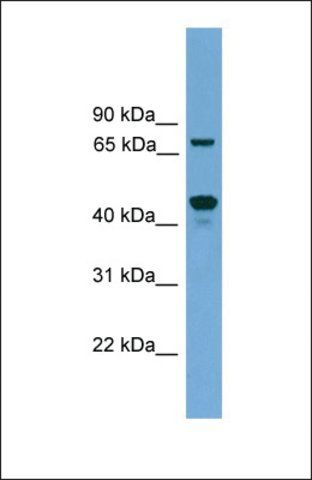 Anti-ZKSCAN17 antibody produced in rabbit