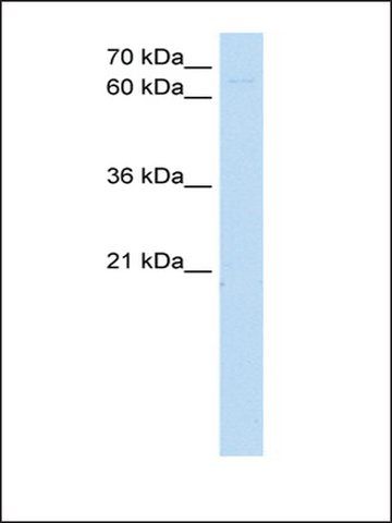 Anti-ZKSCAN1 antibody produced in rabbit