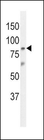 ANTI-ZN160 (N-TERM) antibody produced in rabbit