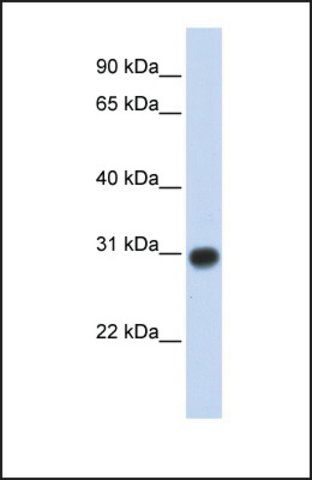 Anti-ZMYND19 antibody produced in rabbit