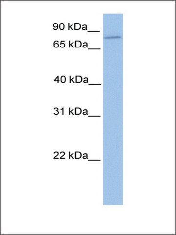 Anti-ZNF555 (AB3) antibody produced in rabbit