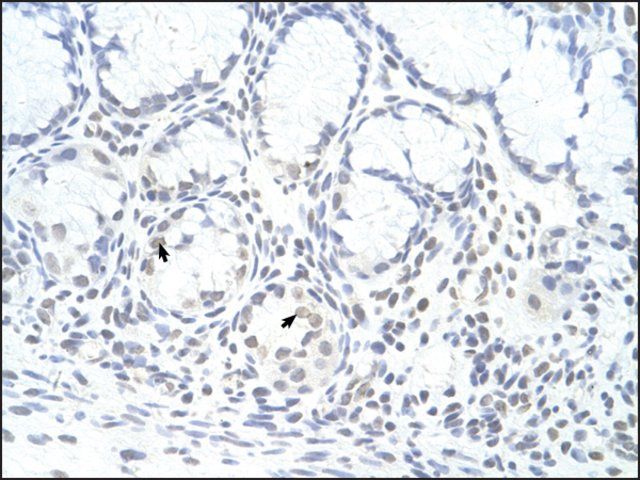 Anti-ZNF580 antibody produced in rabbit