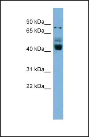 Anti-ZNF620, (N-terminal) antibody produced in rabbit