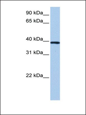 Anti-ZNF618 antibody produced in rabbit