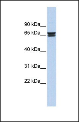 Anti-ZNF614 antibody produced in rabbit