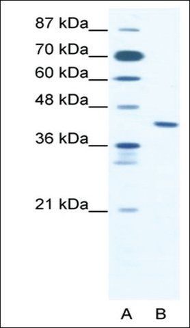 Anti-ZNF621 antibody produced in rabbit