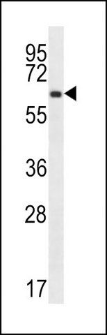 ANTI-ZNF623 (C-TERM) antibody produced in rabbit