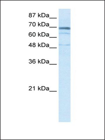 Anti-ZNF614 antibody produced in rabbit