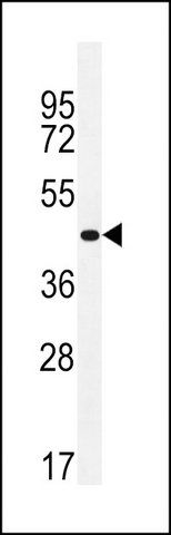 ANTI-ZNF625 (N-TERM) antibody produced in rabbit