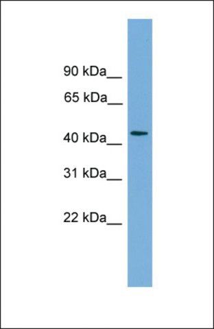 Anti-ZNF620, (N-terminal) antibody produced in rabbit