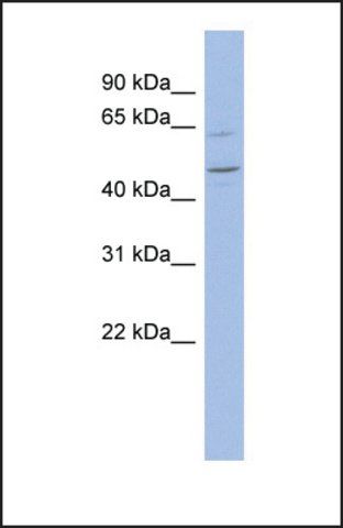 Anti-ZNF619, (N-terminal) antibody produced in rabbit