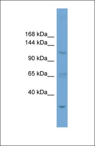 Anti-ZNF624, (N-terminal) antibody produced in rabbit