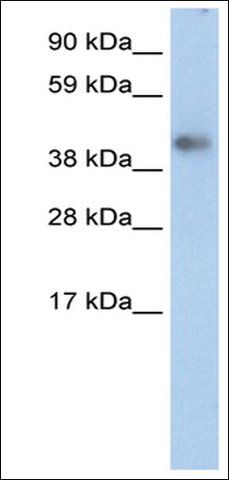 Anti-ZNF620 antibody produced in rabbit