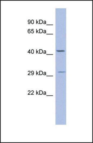 Anti-ZNF575, (N-terminal) antibody produced in rabbit