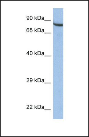 Anti-ZNF630 antibody produced in rabbit