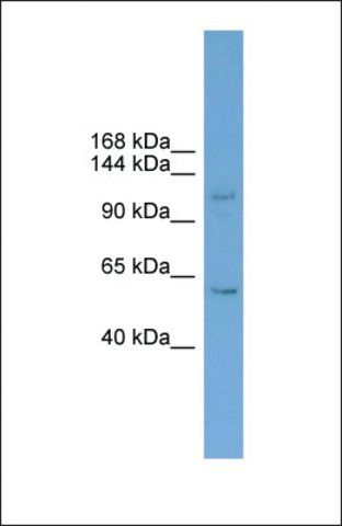 Anti-ZNF628 antibody produced in rabbit