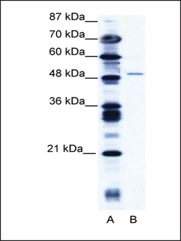 Anti-ZNF627 antibody produced in rabbit