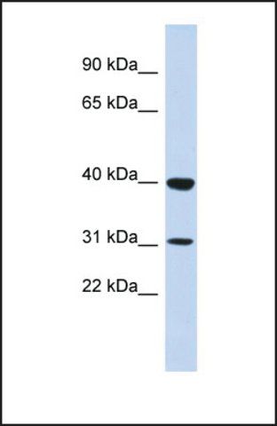 Anti-ZNF660, (N-terminal) antibody produced in rabbit