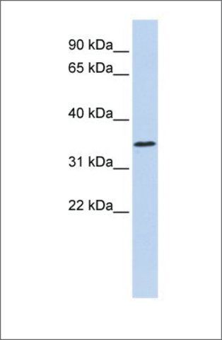 Anti-ZNF660 antibody produced in rabbit