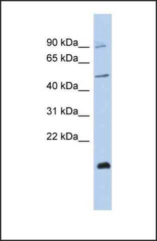 Anti-ZNF645 antibody produced in rabbit