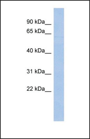 Anti-ZNF649, (N-terminal) antibody produced in rabbit