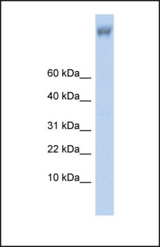 Anti-ZNF644 antibody produced in rabbit