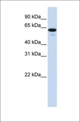 Anti-ZNF655 antibody produced in rabbit