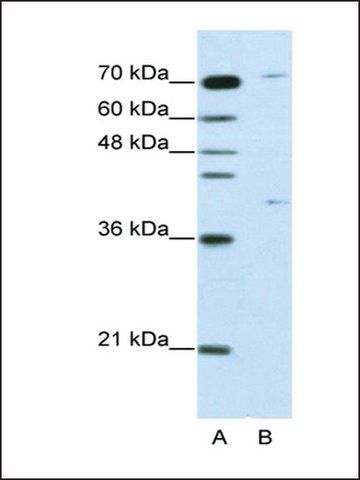 Anti-ZNF668 (AB2) antibody produced in rabbit