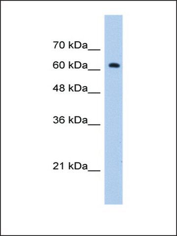 Anti-ZNF675 antibody produced in rabbit