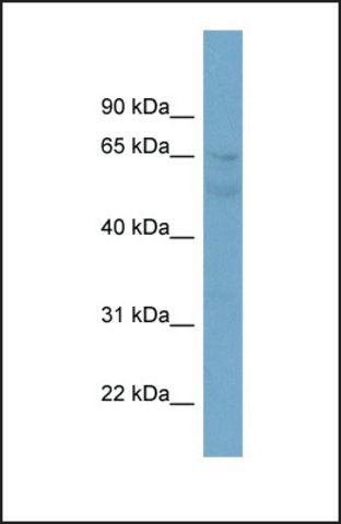 Anti-ZNF671, (N-terminal) antibody produced in rabbit