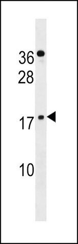 ANTI-ZNF663(C-TERMINAL) antibody produced in rabbit