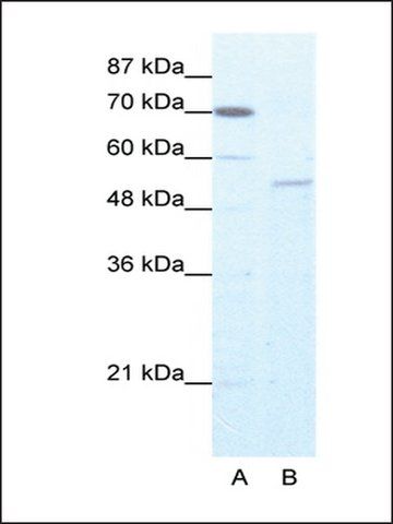 Anti-ZNF665 (AB2) antibody produced in rabbit