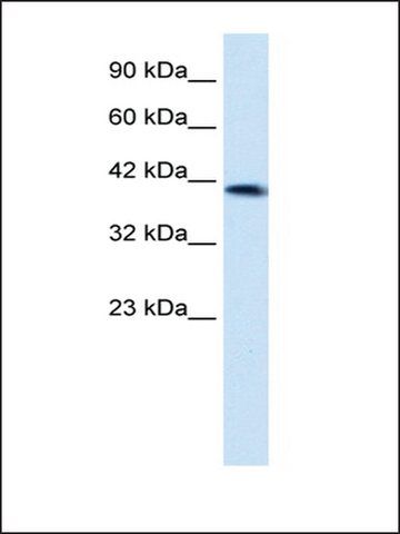 Anti-ZNF670 antibody produced in rabbit