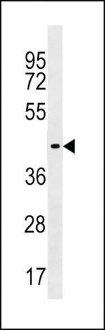 ANTI-ZNF662(C-TERMINAL) antibody produced in rabbit