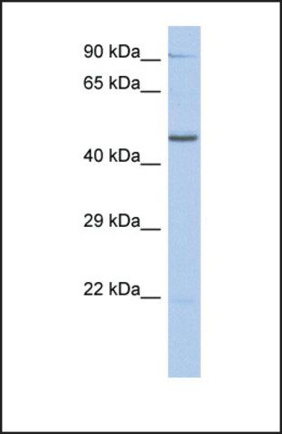 Anti-ZNF669, (N-terminal) antibody produced in rabbit