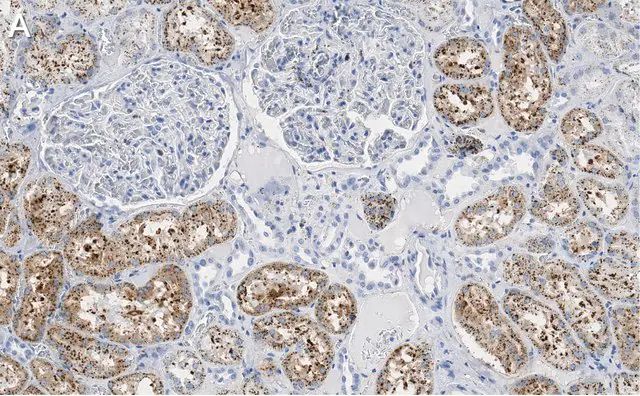 Anti-Cathepsin L1 Antibody, clone 1G2 ZooMAb<sup>®</sup> Rabbit Monoclonal