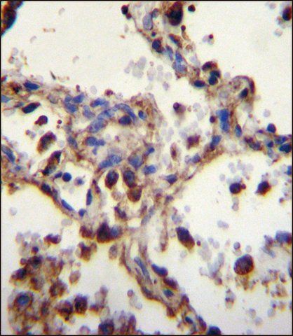 ANTI-WDR52 (C-TERM) antibody produced in rabbit