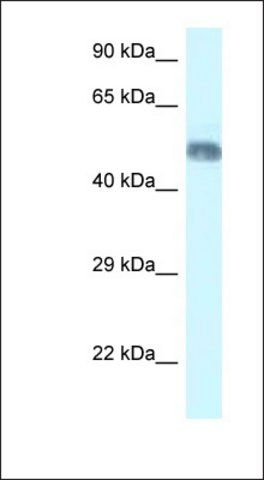 Anti-WDR8 antibody produced in rabbit