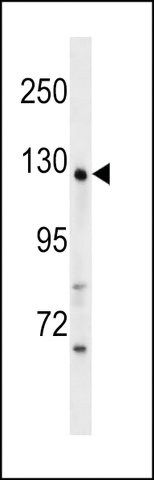 ANTI-WDR64(N-TERMINAL) antibody produced in rabbit