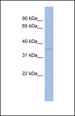 Anti-WNT5B antibody produced in rabbit