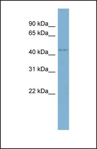 Anti-WDR8 antibody produced in rabbit